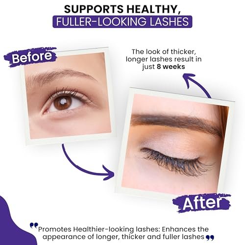 RapidLash Eyelash Enhancing Serum with HEXATEIN 1 Complex – Conditioning & Hydrating Lash Serum for Longer-Looking, Fuller and Thicker Appearing Lashes, 3 mL / 0.1 fl oz Avelisse