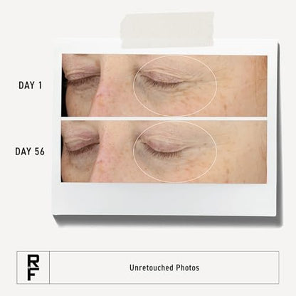 RODAN + FIELDS Redefine Eye Cream | Vitamin C & F Moisturizer for Hydrated, Radiant, Younger-Looking Eyes | 15 ml Avelisse