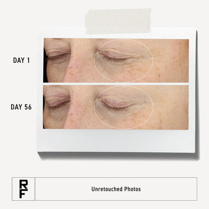 RODAN + FIELDS Redefine Eye Cream | Vitamin C & F Moisturizer for Hydrated, Radiant, Younger-Looking Eyes | 15 ml Avelisse