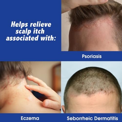 Scalpicin Maximum Strength Scalp Itch Relief, 1.5 fl oz (Pack of 6) Avelisse