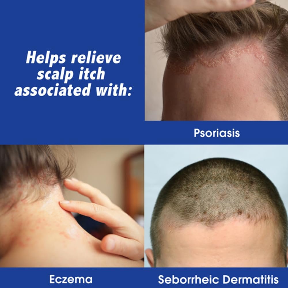 Scalpicin Maximum Strength Scalp Itch Relief, 1.5 fl oz (Pack of 6) Avelisse