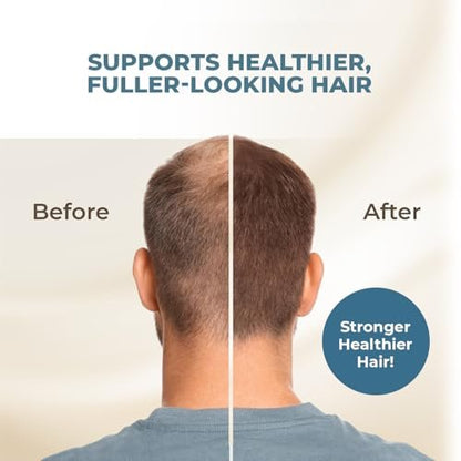 Pumpkin Seed Oil with Saw Palmetto Extract for Hair Growth – 10X Potency Targeted Scalp Treatment with Castor, Lavender Scent & Rosemary Oil for Stronger, Fuller Hair (4 oz) Avelisse