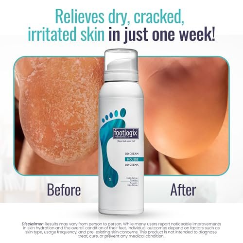 FOOTLOGIX DD Cream Mousse - Intensive Foot Moisturizer for Dry, Cracked Feet - 4.23 oz Avelisse