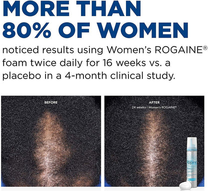 Rogaine 5% Minoxidil Foam for Women – Once-Daily Hair Regrowth Treatment, Unscented, 2-Month Supply (2.11 oz) Avelisse