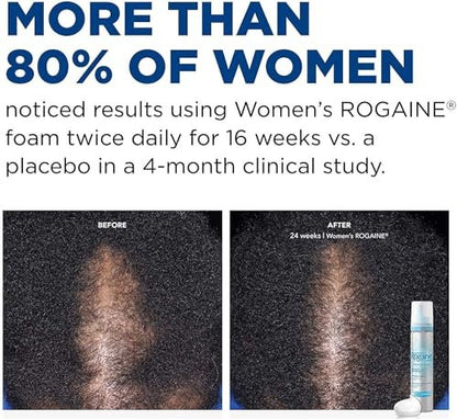 Rogaine 5% Minoxidil Foam for Women – Once-Daily Hair Regrowth Treatment, Unscented, 2-Month Supply (2.11 oz) Avelisse