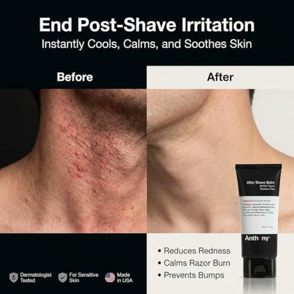 Anthony After Shave Balm for Men - Cooling & Hydrating Aftershave Lotion with Vitamins A, C & E, Aloe Vera & Botanical Extracts - Soothes, Moisturizes & Nourishes Skin, Reduces Razor Burn - 3 fl oz Avelisse