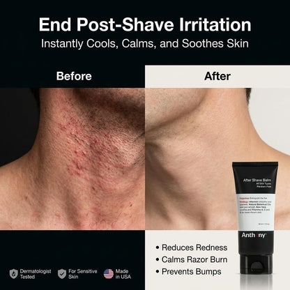 Anthony After Shave Balm for Men - Cooling & Hydrating Aftershave Lotion with Vitamins A, C & E, Aloe Vera & Botanical Extracts - Soothes, Moisturizes & Nourishes Skin, Reduces Razor Burn - 3 fl oz Avelisse