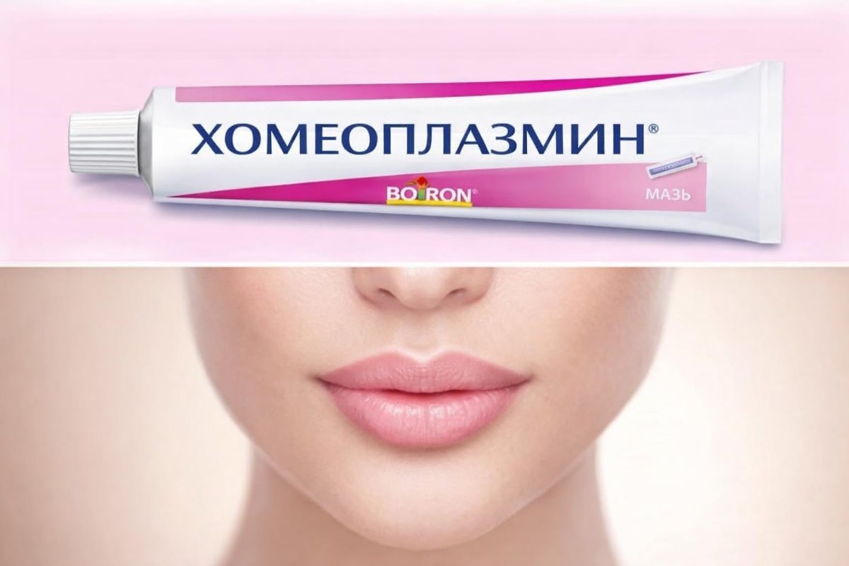 Homeoplasmine, XL - 40g Magic Cream - For Dry Skin, Irritations, for Soft Lips! [The Original French Packaging] Avelisse