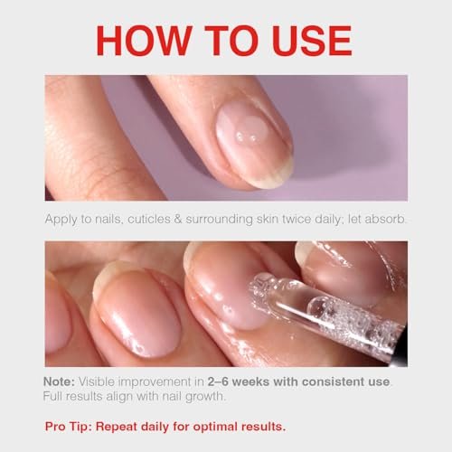 Probelle Natural Renewal Nail Oil – Restore Discolored & Damaged Nails, Clear Topical Solution, 0.5 oz Avelisse