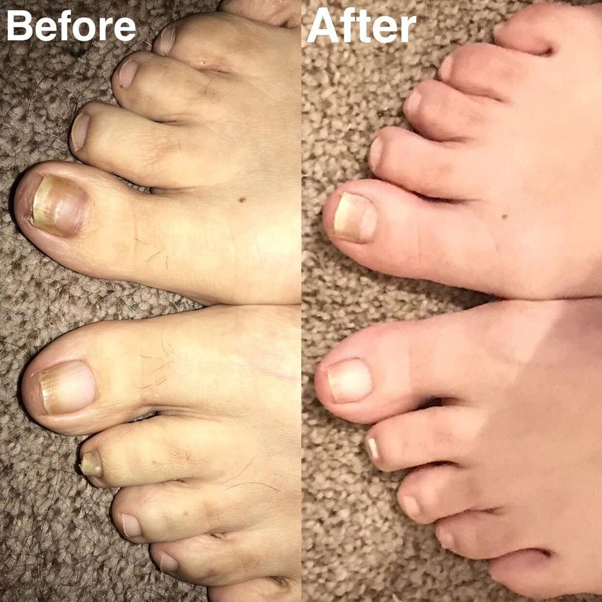 Probelle Natural Renewal Nail Oil – Restore Discolored & Damaged Nails, Clear Topical Solution, 0.5 oz Avelisse