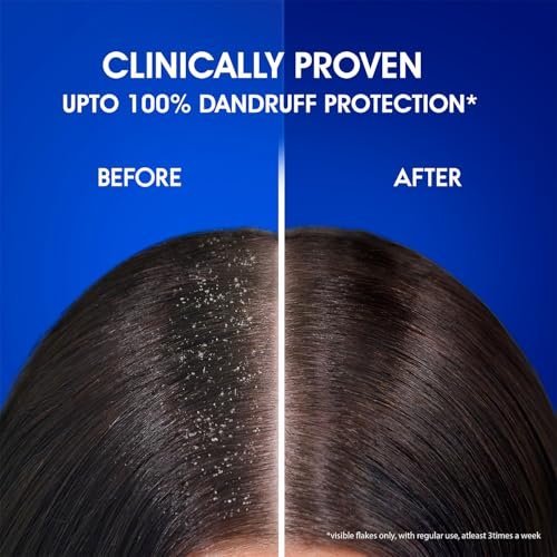 Head & Shoulders Anti-Dandruff Cool Menthol Shampoo, 340ml – Dandruff Relief & Scalp Cooling - görsel 16