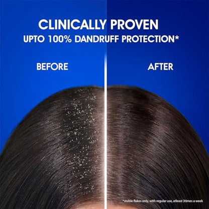Head & Shoulders Anti-Dandruff Cool Menthol Shampoo, 340ml – Dandruff Relief & Scalp Cooling