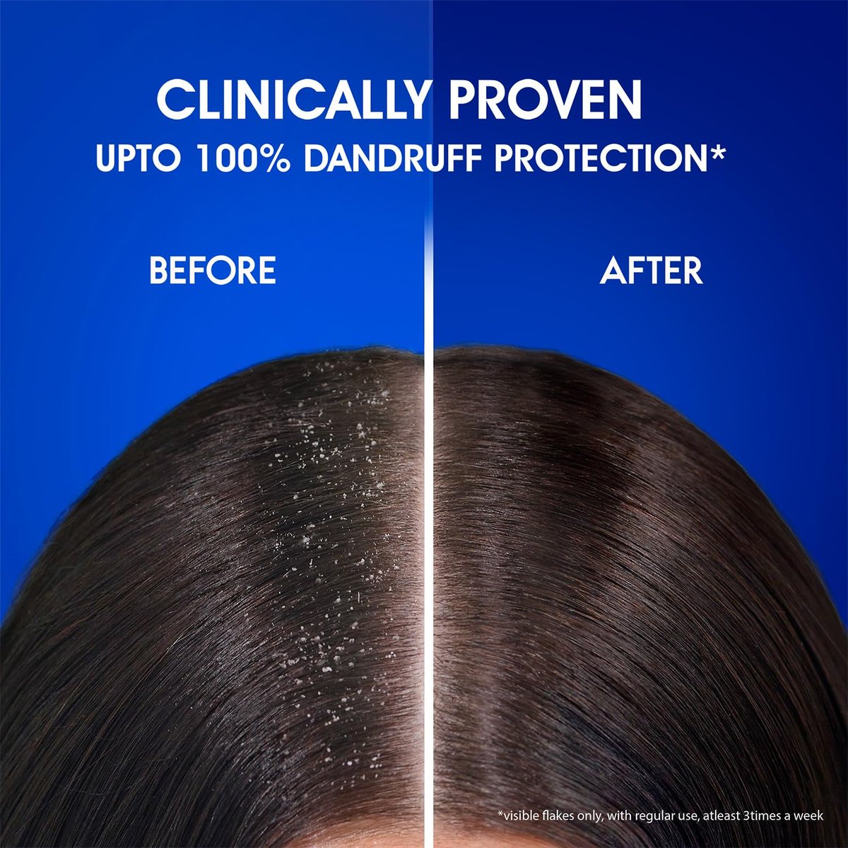Head & Shoulders Anti-Dandruff Cool Menthol Shampoo, 340ml – Dandruff Relief & Scalp Cooling - görsel 15