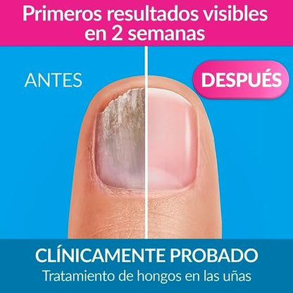 Excilor Nail Varnish Treatment 4ml – Strengthen & Protect Brittle Nails