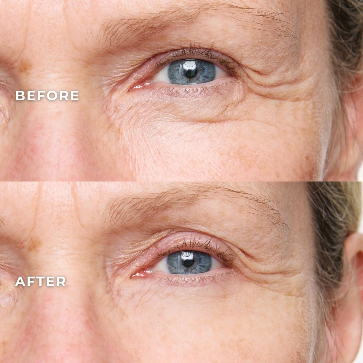 WUNDER2 Wunderlift Instant Eye Tightening Serum – Firm & Lift Under-Eye Bags, Dark Circles & Puffiness in 60 Seconds Avelisse