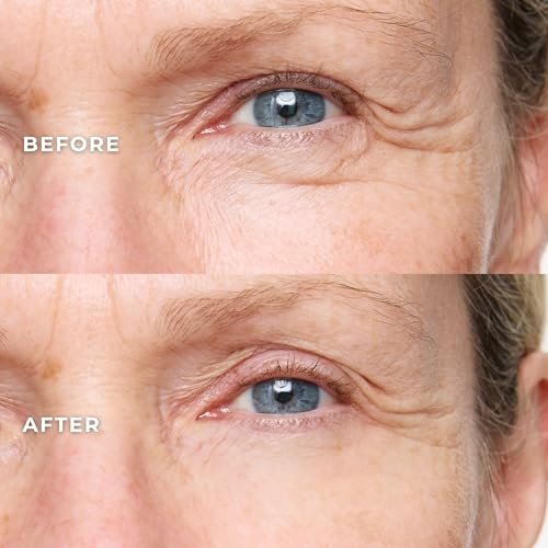 WUNDER2 Wunderlift Instant Eye Tightening Serum – Firm & Lift Under-Eye Bags, Dark Circles & Puffiness in 60 Seconds Avelisse