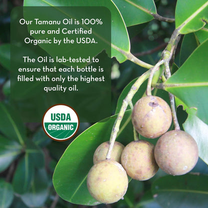 Pure Body Naturals Cold Pressed Tamanu Oil - 4 Fl Oz - Calms Irritated Skin & Moisturises Dry Scaly Skin Avelisse