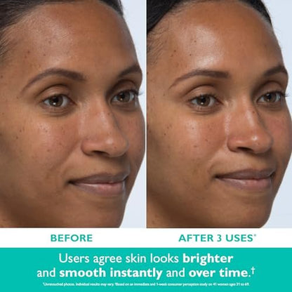 Peter Thomas Roth Even Smoother Instant Reveal Facial Peel – Glycolic Acid Exfoliator for Brightening (8 Pack) Avelisse