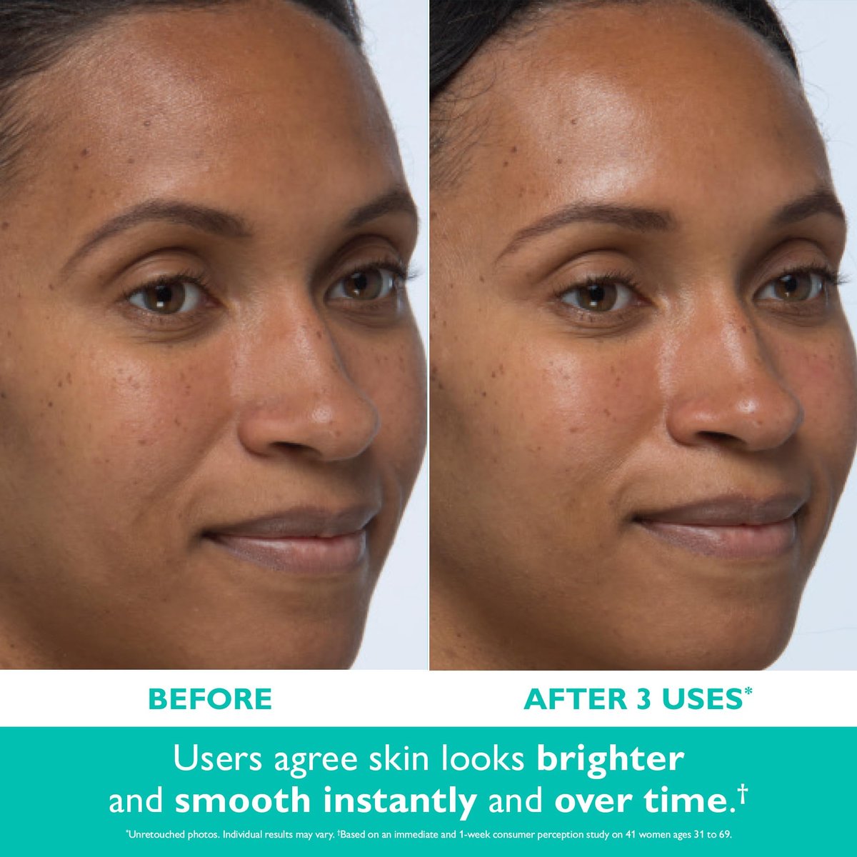 Peter Thomas Roth Even Smoother Instant Reveal Facial Peel – Glycolic Acid Exfoliator for Brightening (8 Pack) Avelisse
