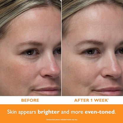 Peter Thomas Roth Potent-C Power Serum – Vitamin C Brightening Serum for Radiant Skin Avelisse