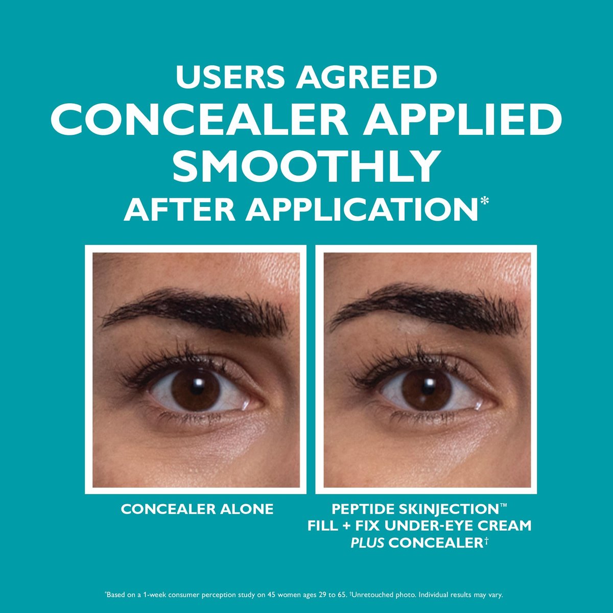 Peter Thomas Roth Peptide Skinjection Fill + Fix Under-Eye Cream – 0.5 Fl Oz Avelisse