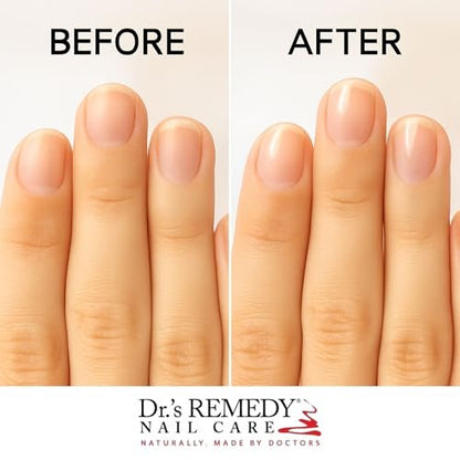 Dr.'s Remedy Total Two-In-One Base And Top Coat Nail Polish Clear Glaze - Quick Dry, Organic Nail Polish Base & Top Coat, 0.5 Fl Oz Avelisse