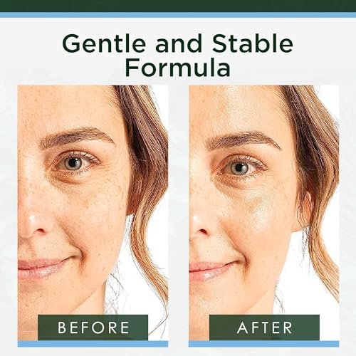 Tree of Life Hyaluronic Acid Serum for Face – Deep Hydration for Dry, Dehydrated & Sensitive Skin – Dermatologist Tested – 2 Fl Oz - görsel 5