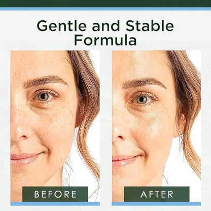 Tree of Life Hyaluronic Acid Serum for Face – Deep Hydration for Dry, Dehydrated & Sensitive Skin – Dermatologist Tested – 2 Fl Oz