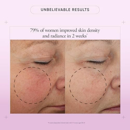 Philosophy Ultimate Miracle Worker Multi-Rejuvenating Face Moisturizer Cream + SPF 30 - Encapsulated Retinol for Firmer, Youthful Looking & Radiant Skin - 2 fl oz Avelisse