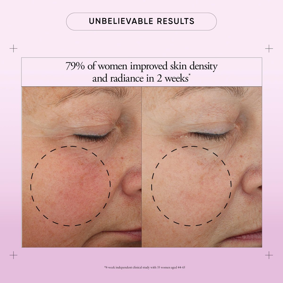 Philosophy Ultimate Miracle Worker Multi-Rejuvenating Face Moisturizer Cream + SPF 30 - Encapsulated Retinol for Firmer, Youthful Looking & Radiant Skin - 2 fl oz Avelisse