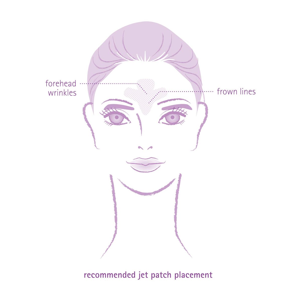 Toute Nuit Wrinkle Patches – Jet – Face Tape for Forehead and Large Frown Lines – Hypoallergenic Anti Wrinkle Patches – 20 Count, Made in USA Avelisse
