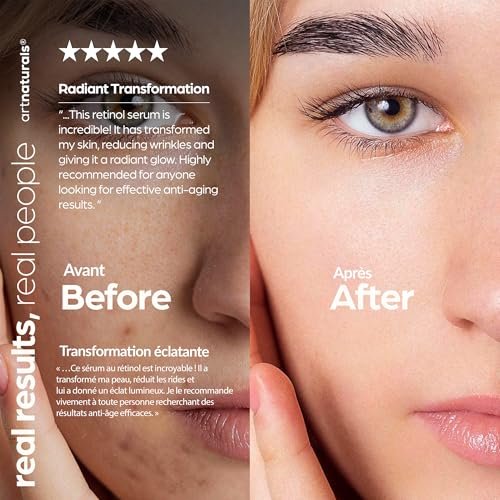 ArtNaturals Retinol Serum for Face - Anti-Aging with Vitamin C, Retinol Oil & Hyaluronic Acid - Night Therapy - 1 Fl Oz Avelisse