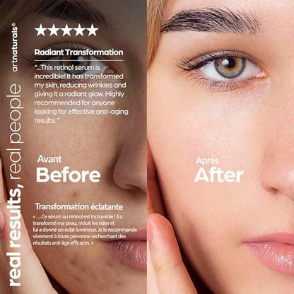 ArtNaturals Retinol Serum for Face - Anti-Aging with Vitamin C, Retinol Oil & Hyaluronic Acid - Night Therapy - 1 Fl Oz Avelisse