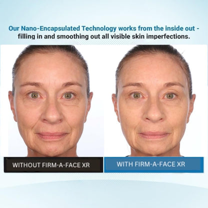 Serious Skincare Firm A Face XR - Instant Temporary Skin Tightener - Invisible Lift for Face and Neck with Retinol - Anti-Aging to Reduce the Look of Fine Lines, Wrinkles and Large Pores - 3.2 Fl Oz Avelisse