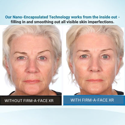 Serious Skincare Firm A Face XR - Instant Temporary Skin Tightener - Invisible Lift for Face and Neck with Retinol - Anti-Aging to Reduce the Look of Fine Lines, Wrinkles and Large Pores - 3.2 Fl Oz Avelisse