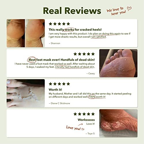 Purederm Shiny & Soft Foot Peeling Mask (3 Pack) - Exfoliate Calluses, Dry Skin & Cracked Heels for Smooth, Baby-Soft Feet - for Men & Women - görsel 16