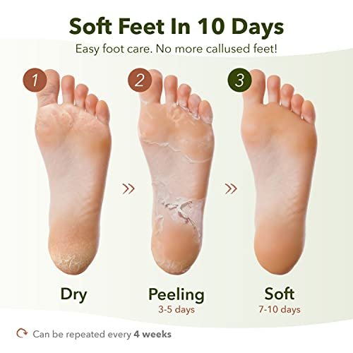 Purederm Shiny & Soft Foot Peeling Mask (3 Pack) - Exfoliate Calluses, Dry Skin & Cracked Heels for Smooth, Baby-Soft Feet - for Men & Women - görsel 6