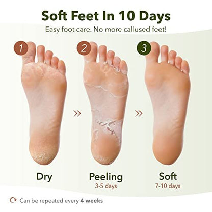 Purederm Shiny & Soft Foot Peeling Mask (3 Pack) - Exfoliate Calluses, Dry Skin & Cracked Heels for Smooth, Baby-Soft Feet - for Men & Women