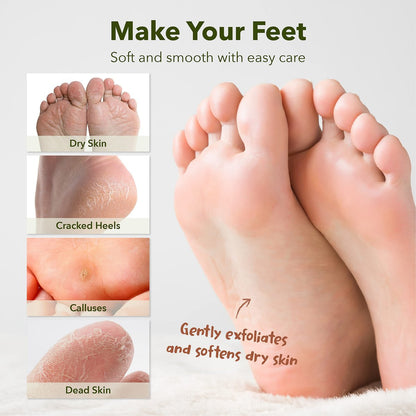 Purederm Shiny & Soft Foot Peeling Mask (3 Pack) - Exfoliate Calluses, Dry Skin & Cracked Heels for Smooth, Baby-Soft Feet - for Men & Women
