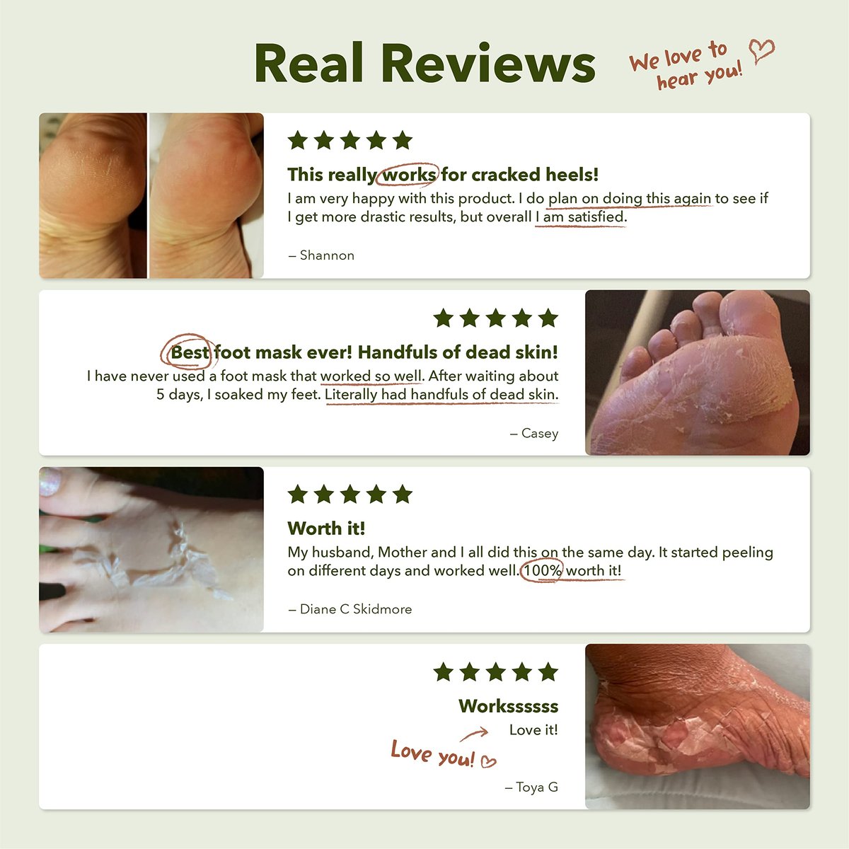 Purederm Shiny & Soft Foot Peeling Mask (3 Pack) - Exfoliate Calluses, Dry Skin & Cracked Heels for Smooth, Baby-Soft Feet - for Men & Women - görsel 15