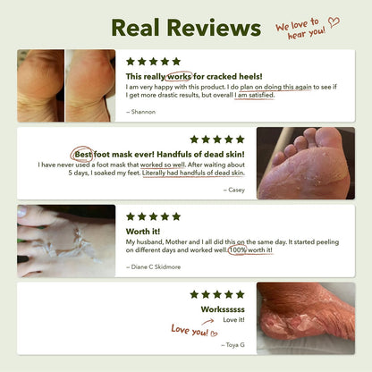 Purederm Shiny & Soft Foot Peeling Mask (3 Pack) - Exfoliate Calluses, Dry Skin & Cracked Heels for Smooth, Baby-Soft Feet - for Men & Women