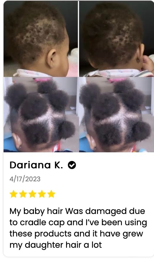 J'Organic Solutions Natural Kid's Hair Growth Stimulator – Lanolin, Sweet Almond & Castor Oil Hair Grease for Soft, Shiny Hair (4 fl oz) Avelisse
