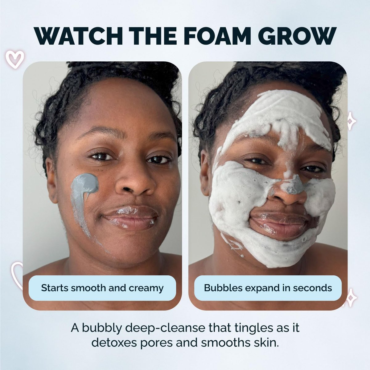 Elizabeth Mott Carbonated Bubble Detox Clay Mask – Deep Pore Cleansing Charcoal Face Mask for Acne, Blackheads & Oil Control – Cruelty-Free Korean Skincare, 3.53 oz - görsel 9