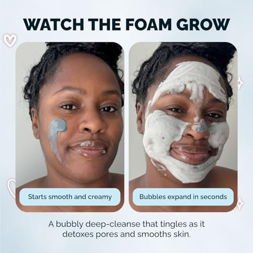 Elizabeth Mott Carbonated Bubble Detox Clay Mask – Deep Pore Cleansing Charcoal Face Mask for Acne, Blackheads & Oil Control – Cruelty-Free Korean Skincare, 3.53 oz - görsel 10