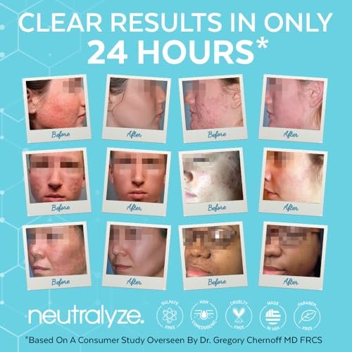 Neutralyze Moderate to Severe Acne Face Wash 2.0 – Maximum Strength 2% Mandelic Acid & 2% Salicylic Acid Facial Cleanser for Acne Prone Skin, 5 FL OZ - görsel 8