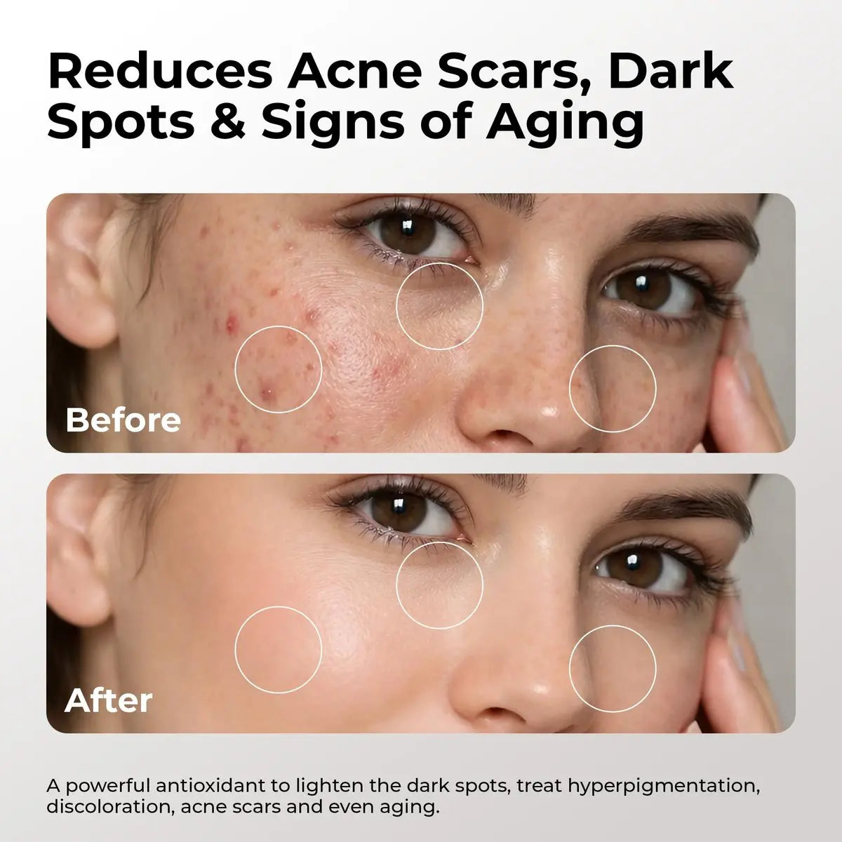 Skin Deva 20% Vitamin C Serum Anti Aging with Hyaluronic Acid & Vitamin E Ferulic Acid - Brightening Formula for Improving Appearance of Dark Spots, Fine Lines & Wrinkles - All Skin Types, 1 fl oz Avelisse