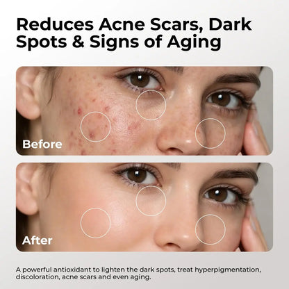 Skin Deva 20% Vitamin C Serum Anti Aging with Hyaluronic Acid & Vitamin E Ferulic Acid - Brightening Formula for Improving Appearance of Dark Spots, Fine Lines & Wrinkles - All Skin Types, 1 fl oz Avelisse