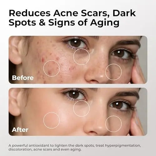 Skin Deva 20% Vitamin C Serum Anti Aging with Hyaluronic Acid & Vitamin E Ferulic Acid - Brightening Formula for Improving Appearance of Dark Spots, Fine Lines & Wrinkles - All Skin Types, 1 fl oz Avelisse