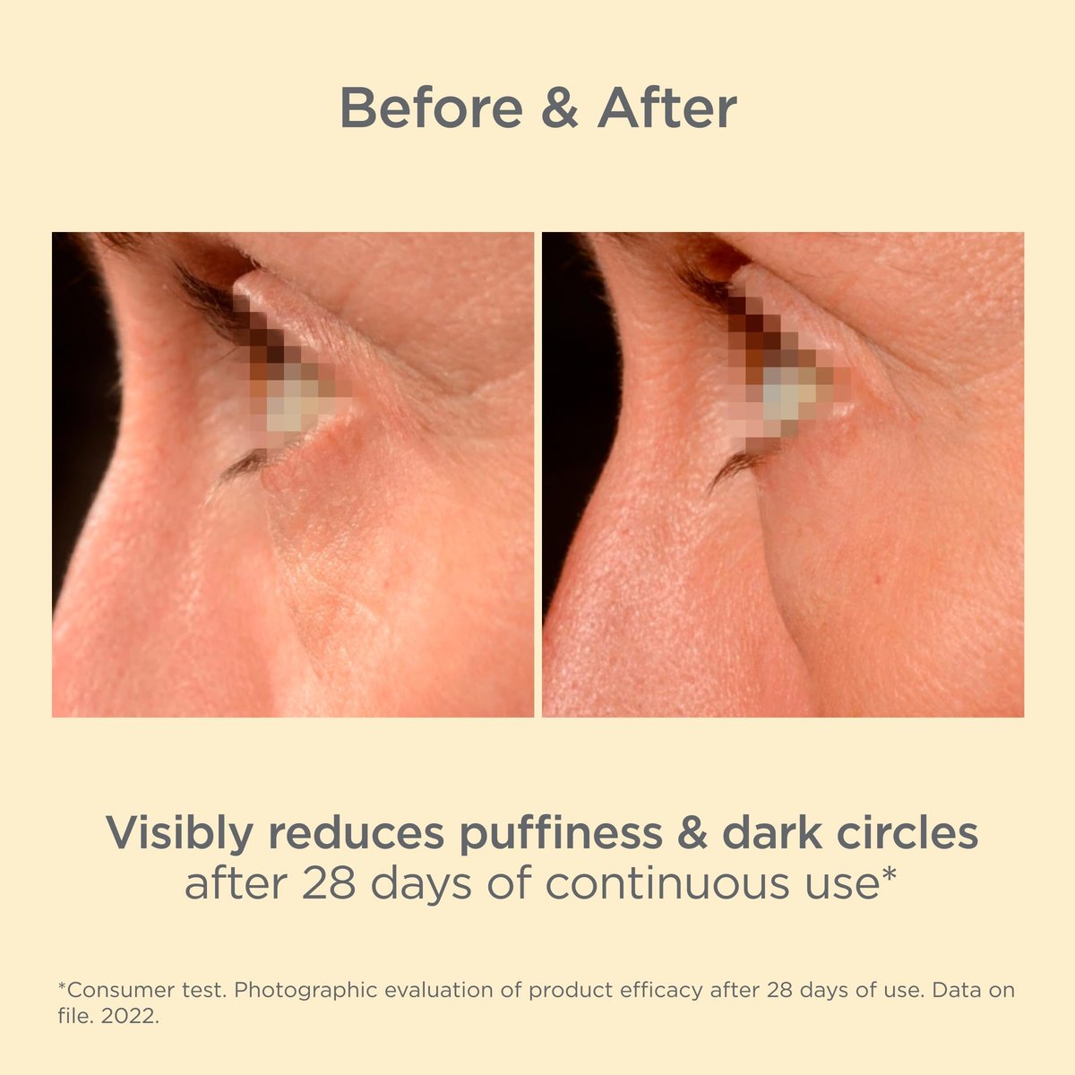 ISDIN Isdinceutics K-Ox Eyes - Rich Vitamin K Oxide Eye Cream for Dark Circles and Under-Eye Rejuvenation, 0.5 OZ Avelisse