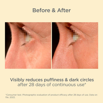 ISDIN Isdinceutics K-Ox Eyes - Rich Vitamin K Oxide Eye Cream for Dark Circles and Under-Eye Rejuvenation, 0.5 OZ Avelisse